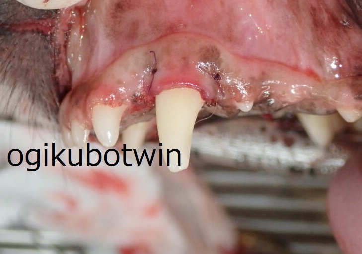 犬歯　再生治療　治療後